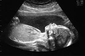 Accomplish an incredible big surprise together with the assist of your fake sonogram